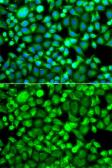 Anti-PSMB8 antibody used in Immunocytochemistry/ Immunofluorescence (ICC/IF). GTX55763