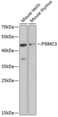 Anti-PSMC3 antibody used in Western Blot (WB). GTX55764