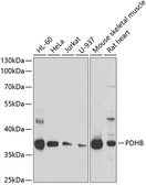 Anti-Pyruvate Dehydrogenase E1 beta subunit antibody used in Western Blot (WB). GTX55769