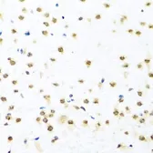 Anti-RAB3IP antibody used in IHC (Paraffin sections) (IHC-P). GTX55771