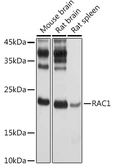 Anti-Rac1 antibody used in Western Blot (WB). GTX55772
