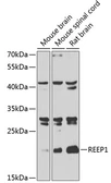 Anti-REEP1 antibody used in Western Blot (WB). GTX55777