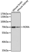 Anti-ROR alpha antibody used in Western Blot (WB). GTX55784