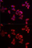 Anti-RPL9 antibody used in Immunocytochemistry/ Immunofluorescence (ICC/IF). GTX55785