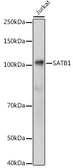 Anti-SATB1 antibody used in Western Blot (WB). GTX55787