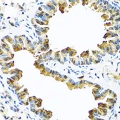 Anti-SERPINA10 antibody used in IHC (Paraffin sections) (IHC-P). GTX55791
