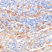 Anti-Serum Amyloid P antibody used in IHC (Paraffin sections) (IHC-P). GTX55792