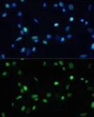 Anti-SET antibody used in Immunocytochemistry/ Immunofluorescence (ICC/IF). GTX55793