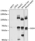 Anti-SGSH antibody used in Western Blot (WB). GTX55796
