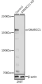Anti-SMARCC1 antibody used in Western Blot (WB). GTX55802