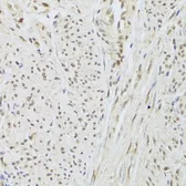 Anti-SNRPA antibody used in IHC (Paraffin sections) (IHC-P). GTX55804