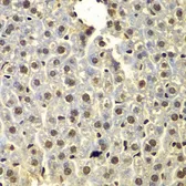 Anti-SSX5 antibody used in IHC (Paraffin sections) (IHC-P). GTX55807