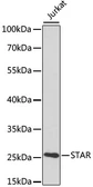 Anti-StAR antibody used in Western Blot (WB). GTX55809