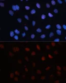 Anti-SUMO1 antibody used in Immunocytochemistry/ Immunofluorescence (ICC/IF). GTX55812