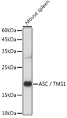 Anti-TMS1 antibody used in Western Blot (WB). GTX55818