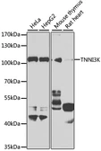 Anti-TNNI3K antibody used in Western Blot (WB). GTX55819