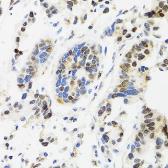 Anti-Topoisomerase I antibody used in IHC (Paraffin sections) (IHC-P). GTX55820