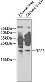 Anti-Trefoil Factor 3 antibody used in Western Blot (WB). GTX55821