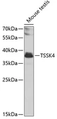 Anti-TSSK4 antibody used in Western Blot (WB). GTX55823