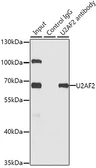 Anti-U2AF65 antibody used in Immunoprecipitation (IP). GTX55828
