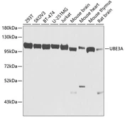 Anti-UBE3A antibody used in Western Blot (WB). GTX55832