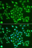 Anti-UCHL5 antibody used in Immunocytochemistry/ Immunofluorescence (ICC/IF). GTX55834