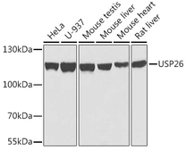 Anti-USP26 antibody used in Western Blot (WB). GTX55837