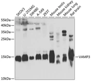 Anti-VAMP3 antibody used in Western Blot (WB). GTX55838