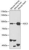 Anti-VAP1 antibody used in Western Blot (WB). GTX55839
