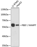 Anti-Visfatin antibody used in Western Blot (WB). GTX55840