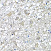 Anti-VPS37A antibody used in IHC (Paraffin sections) (IHC-P). GTX55841
