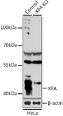 Anti-XPA antibody used in Western Blot (WB). GTX55843