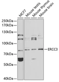 Anti-XPB antibody used in Western Blot (WB). GTX55844