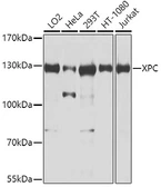 Anti-XPC antibody used in Western Blot (WB). GTX55845