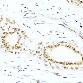 Anti-XRCC4 antibody used in IHC (Paraffin sections) (IHC-P). GTX55846