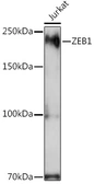 Anti-ZEB1 antibody used in Western Blot (WB). GTX55847