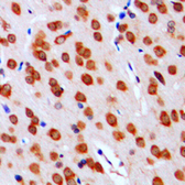 Anti-DGKA antibody used in IHC (Paraffin sections) (IHC-P). GTX55856