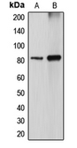 Anti-DGKA antibody used in Western Blot (WB). GTX55856