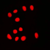 Anti-BRF1 antibody used in Immunocytochemistry/ Immunofluorescence (ICC/IF). GTX55860