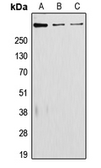 Anti-Laminin alpha 5 antibody used in Western Blot (WB). GTX55867