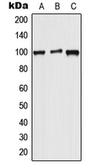 Anti-WFS1 antibody used in Western Blot (WB). GTX55899