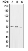 Anti-SNX4 antibody used in Western Blot (WB). GTX55902