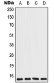 Anti-COX7A2L antibody used in Western Blot (WB). GTX55913