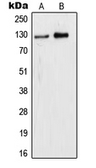 Anti-WDHD1 antibody used in Western Blot (WB). GTX55930