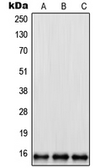 Anti-RPL35 antibody used in Western Blot (WB). GTX55931