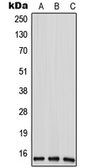 Anti-ANP32D antibody used in Western Blot (WB). GTX55938