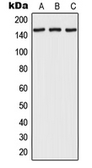 Anti-RPAP1 antibody used in Western Blot (WB). GTX55944
