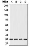 Anti-CABYR antibody used in Western Blot (WB). GTX55946