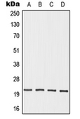 Anti-OAZ3 antibody used in Western Blot (WB). GTX55956