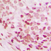 Anti-NEI3 antibody used in IHC (Paraffin sections) (IHC-P). GTX55960